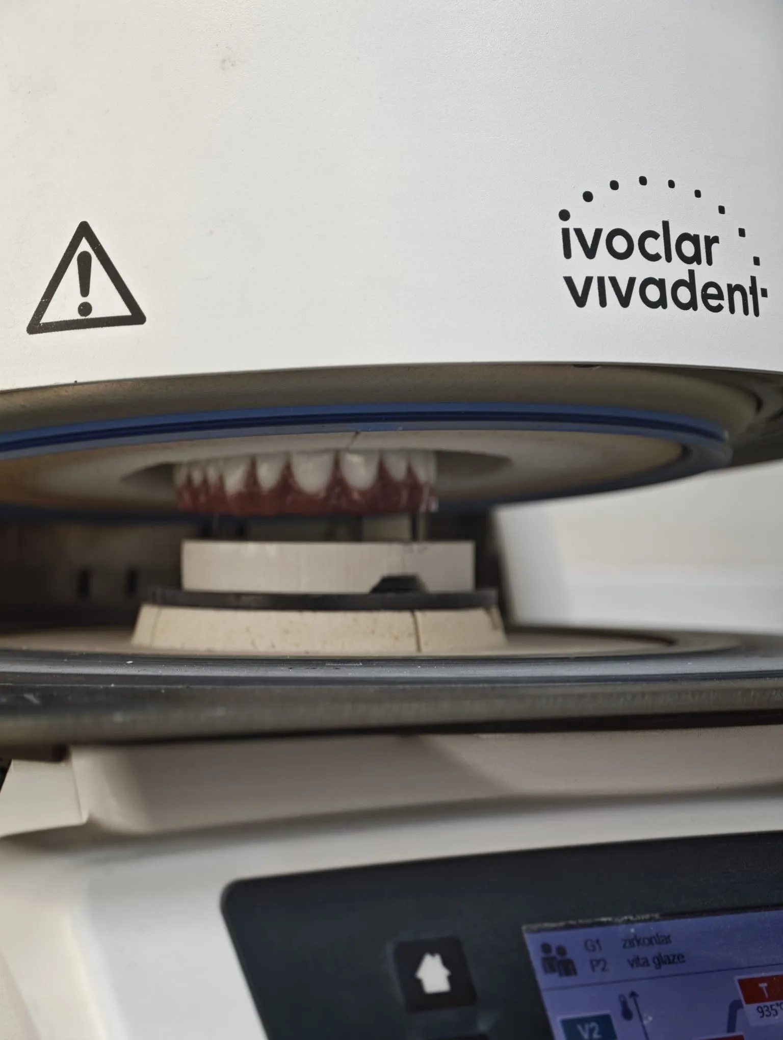 Laboratorio odontotecnico interno con attrezzature Ivoclar